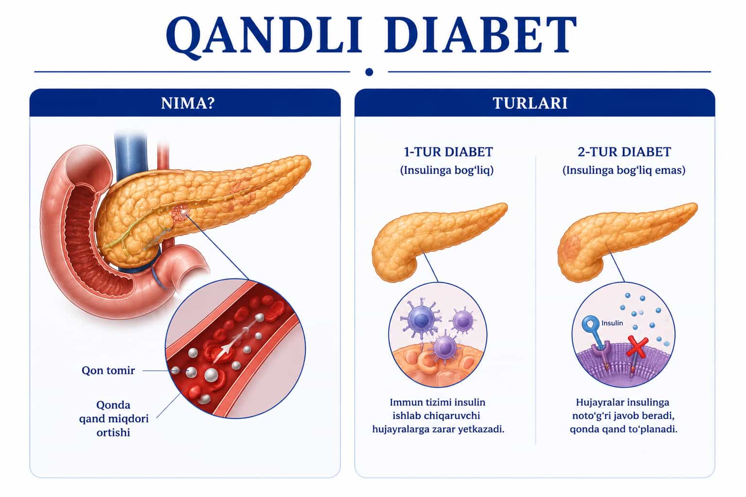 Qandli diabet